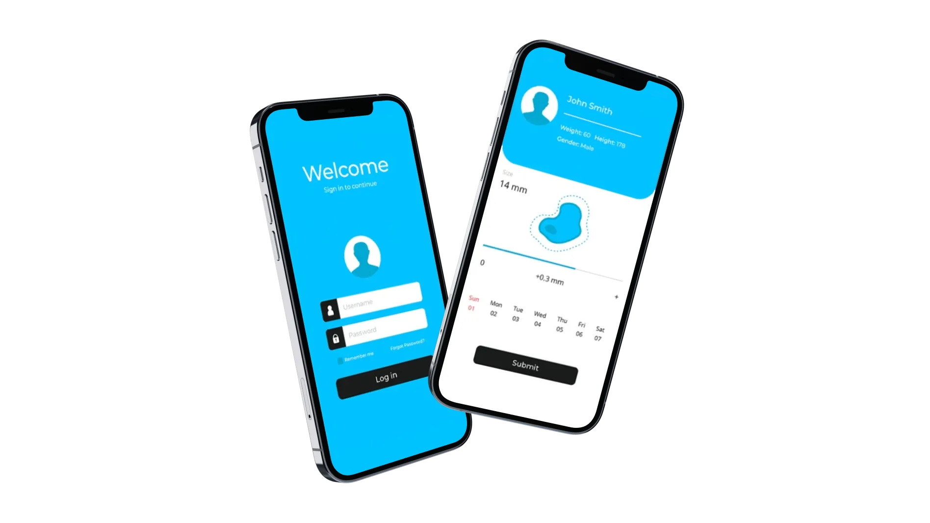 Automated melanoma prevention and detection app UI showcase